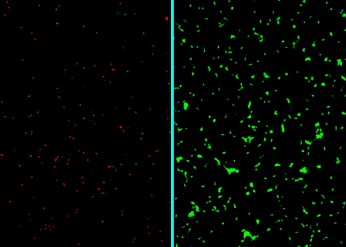 neurons alzheimer nanotherapy
